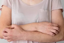 Penyakit Kusta di Rumania